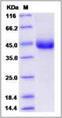 Human TNF Receptor II protein, His tag (active)