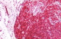 CD45RA antibody [MEM-56]