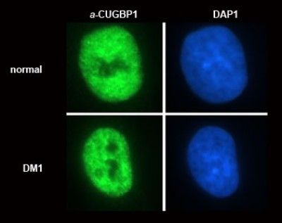 CUGBP1 antibody [3B1]
