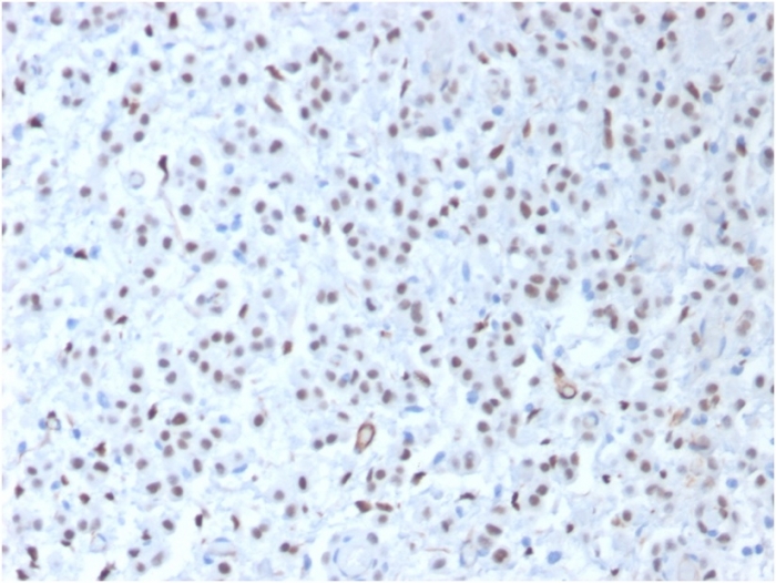 Wilms Tumor 1 antibody [WT1/1434R]