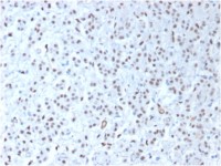 Wilms Tumor 1 antibody [WT1/1434R]