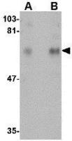 CPEB1 antibody