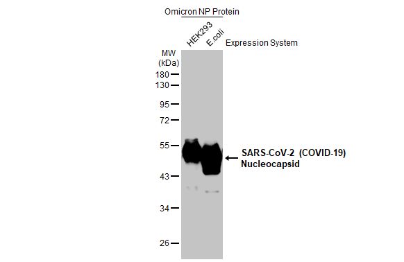 SARS-CoV-2 (COVID-19) Nucleocapsid protein, B.1.1.529 / Omicron variant, His tag