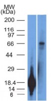 TRIM29 antibody [TRIM29/1042]