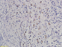HOXB8 antibody