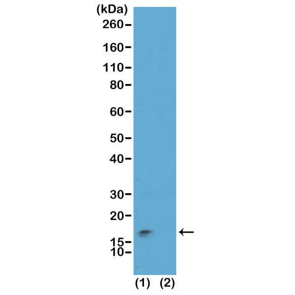 Histone H3K9me3S10ph (Tri-methyl Lys9 / phospho Ser10) antibody [RM162]