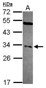 NFYB antibody [N1C3-2]