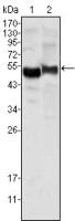 alpha 1 Antitrypsin antibody [2B12]