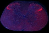 Substance P antibody