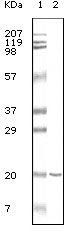 CD19 antibody [2E2B6B10]
