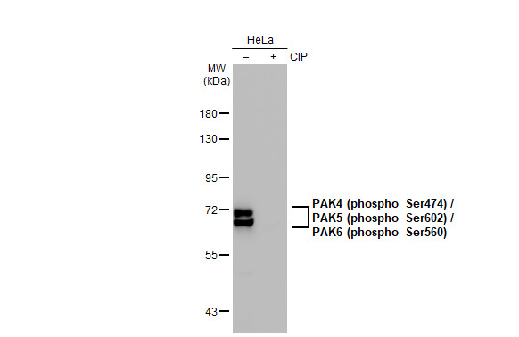 PAK4 (phospho Ser474) / PAK5 (phospho Ser602) / PAK6 (phospho Ser560) antibody [GT1344]