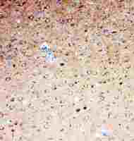 Serotonin Transporter antibody