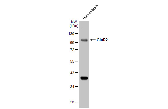 GluR2 antibody [GT1283]