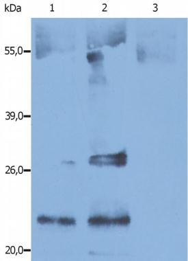CD9 antibody [IVA50]