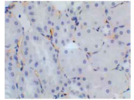 VEGF Receptor 2 antibody [6C23]