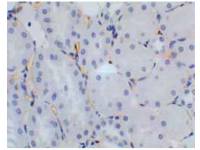 VEGF Receptor 2 antibody [6C23]