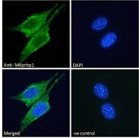TIP47 antibody, Internal