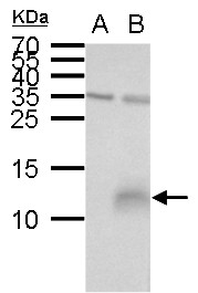 Elafin antibody