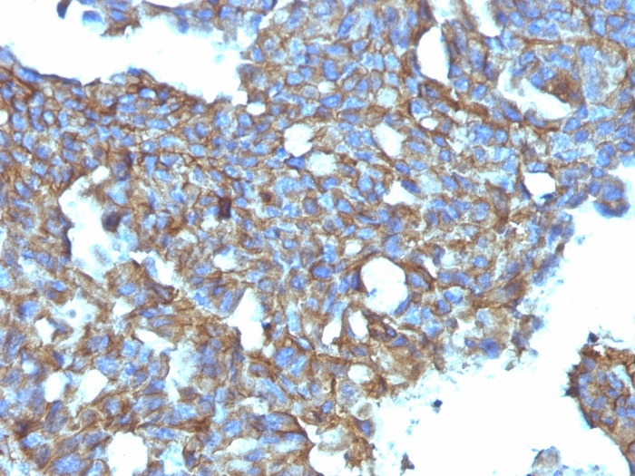 CD99 antibody [MIC2/877]
