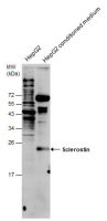 Sclerostin antibody
