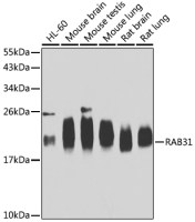 RAB31 antibody