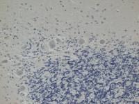 DECR1 antibody [8B1AD10]