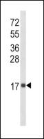 CXCL8 / IL8 antibody, C-term