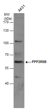 PPP2R5B antibody