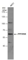 PPP2R5B antibody