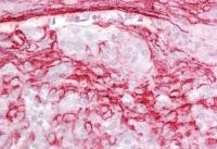 IGFBP7 antibody, Internal