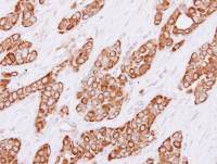 Cytokeratin 4 antibody