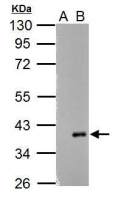 ARPC1A antibody