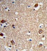 ACTR5 antibody, C-term