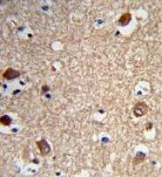 ACTR5 antibody, C-term