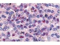 Cyclin L1 (Isoform 1) antibody