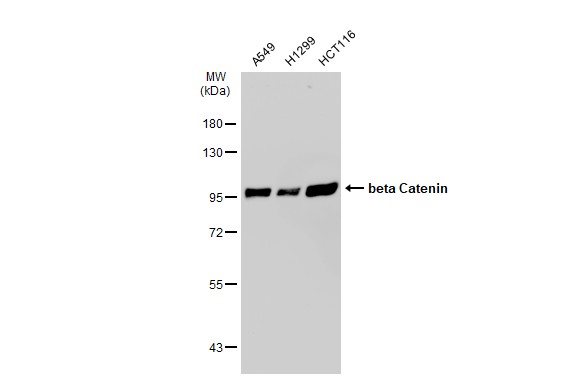 beta Catenin antibody [GT1186]