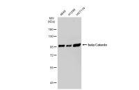 beta Catenin antibody [GT1186]