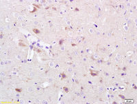 CACNA1G antibody