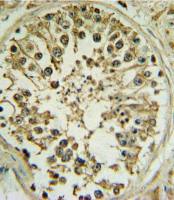 Wnt1 antibody, C-term