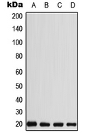 CABP5 antibody
