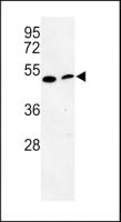PISD antibody, Internal