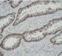 hnRNP K antibody [F45 P9 C7]