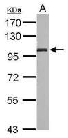 SLC9A8 antibody