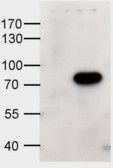 ABCD1 antibody, Internal