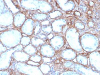 Collagen IV antibody [rCOL4/4742]