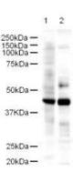 LDB2 antibody