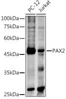 PAX2 antibody