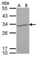 CREM antibody