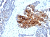 TAG72 antibody [CA72/2869R]