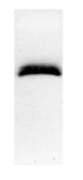 S100 alpha antibody